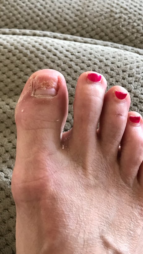 An Important Lesson From My Big Toe